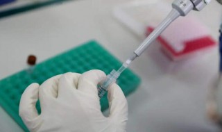 核酸检测前后注意什么（核酸检测前后注意什么问题）