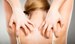 晒脱皮了怎么办（晒脱皮了怎么办才能快速恢复）