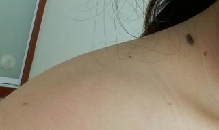 锁骨上有痣代表什么（右边锁骨上有痣代表什么）