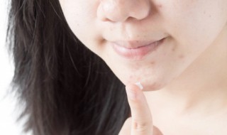 粉刺和闭口的区别（粉刺和闭口的区别图片 对比）