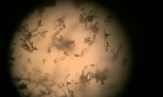 户尘螨是什么东西（户尘螨是什么东西图片）