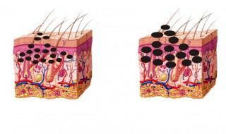 怎样才能祛斑 怎样才能祛斑祛黑色素