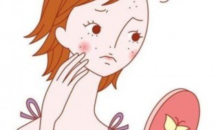 怎样祛痘痘 怎样祛痘痘天然方法