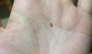 掌心有痣代表什么（掌心有痣代表什么意思）