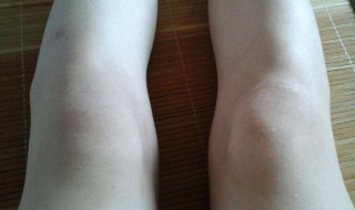 让膝盖变瘦的方法 如何让膝盖