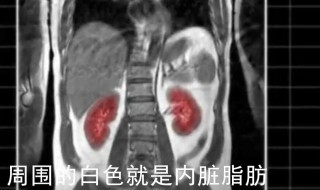 怎么知道是不是内脏脂肪多 怎么知道是不是内脏脂肪多呢