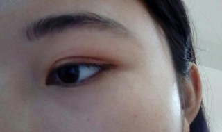 怎样贴双眼皮贴（怎样贴双眼皮贴视频）