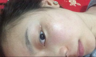 斑怎样才能清除 斑怎么除掉