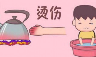 被火烫了怎么解决 被火烫了怎么解决伤口