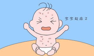 宝宝长痱子用什么擦好（婴儿长痱子擦什么好）