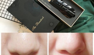 黑头一直不挤会怎样（黑头怎么去除最有效）