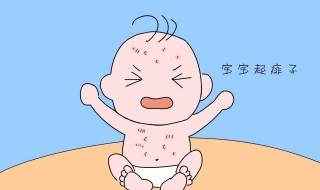 去痱子的最快方法 去痱子的最快方法介绍