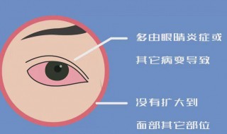 右眼跳代表什么 右眼跳代表什么预兆女